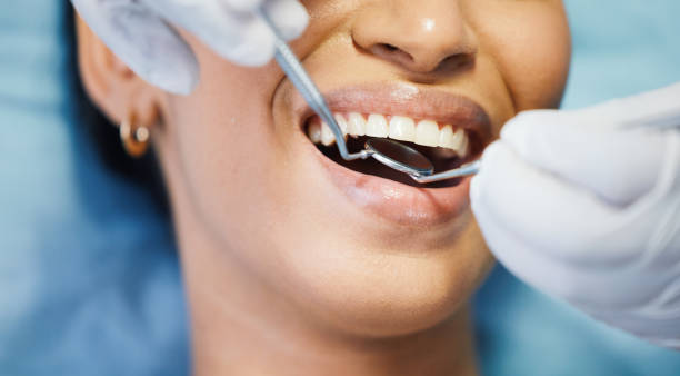 Best Same-Day Emergency Dentist in Highlands, TX